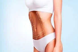 Liposuction Surgery